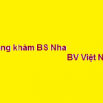 Phòng khám Bác sĩ Nha bệnh viện việt nhật ở đâu? giá khám bao nhiêu?